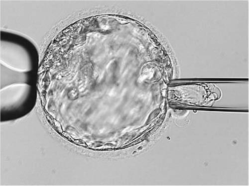 blastocyst