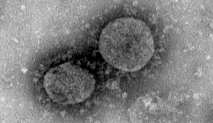 Hong Kong coronavirus LFI