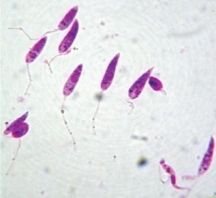 Formes flagellées de Leishmania Donovani 